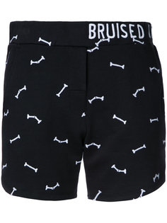 Bruised Not Broken shorts  Zoe Karssen