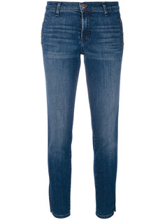 button detail skinny jeans J Brand