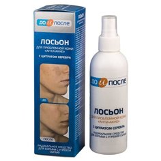 До и После Лосьон для проблемной кожи, анти-акне, 200 мл