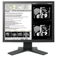 Монитор Eizo Radiforce MX194 19