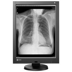 Монитор Eizo RadiForce GX340CLP