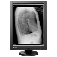 Монитор Eizo RadiForce GX240CLP