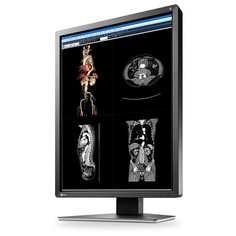 Монитор Eizo RadiForce MX216 21.3