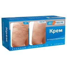 До и После крем антицеллюлитный 100 мл
