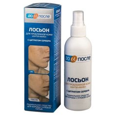 До и После Лосьон для проблемной кожи, анти-акне, 200 мл