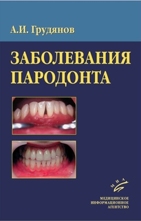 Книга Заболевания пародонта, гриф УМО / Грудянов А.И MIA