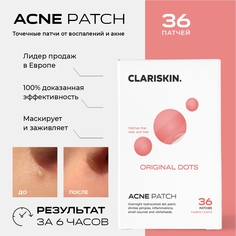 Точечные патчи от прыщей и акне Clariskin 36 шт