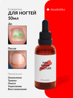 Сыворотка для ногтей стоп онихолизис AkadeMika Nail Repair Tincture 50мл